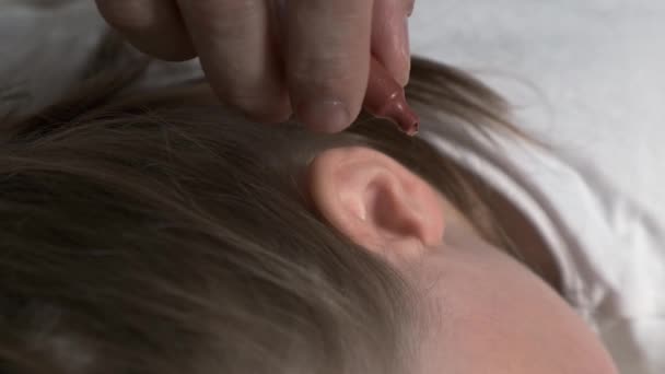 Крупним планом чоловіча рука кидає ліки в вухо хворої дитини . — стокове відео