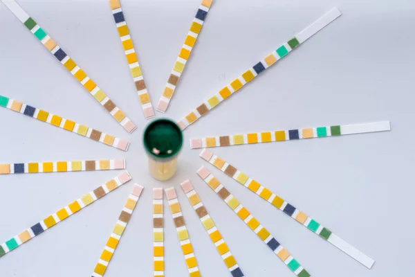 İdrar numuneleri, enfeksiyon tespit için hızlı testler