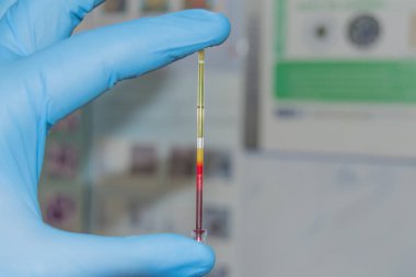 Analiz için kan örneği