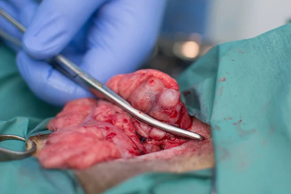 Yumurtalık Kist ve rahim bir orospu. Yumurtalık bağ bir kan durdurucu sargı kelepçe ile sabittir. Arka planda bulanık cerrahi aletler vardır