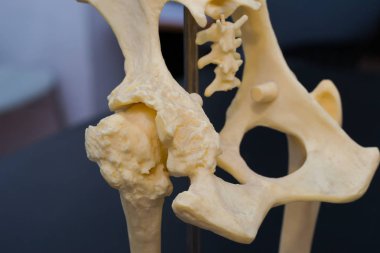 köpek kalça kalıp, normal kalça ve kalça artroz ile