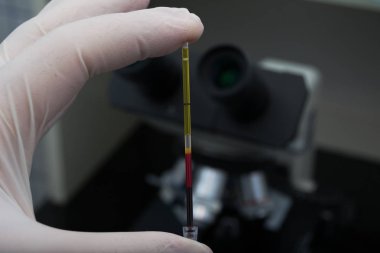 centrifuged kan örneği elinde tutan bilim adamı 