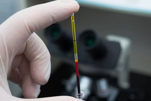 Científico sosteniendo en su mano una muestra de sangre centrífuga — Foto de Stock