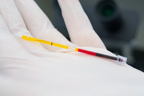 Вчений тримає в руці центрифужну пробу крові — стокове фото