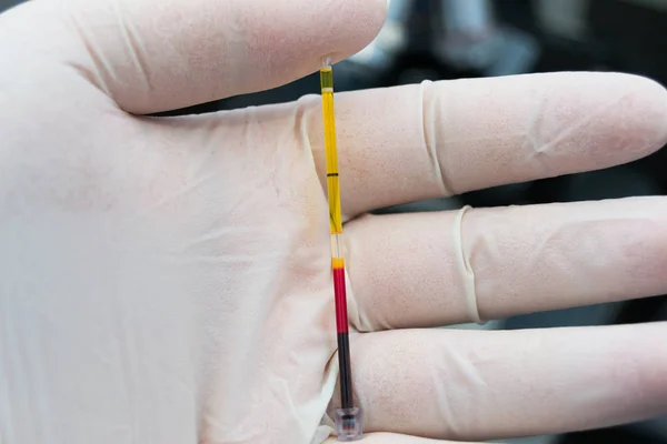 Científico sosteniendo en su mano una muestra de sangre centrífuga — Foto de Stock