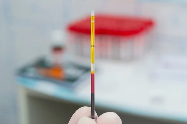 Cientista segurando em sua mão uma amostra de sangue centrifugado — Fotografia de Stock