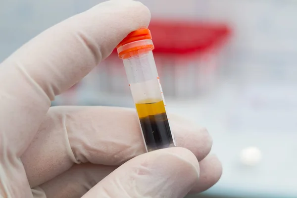 centrifuged kan örneği elinde tutan bilim adamı 