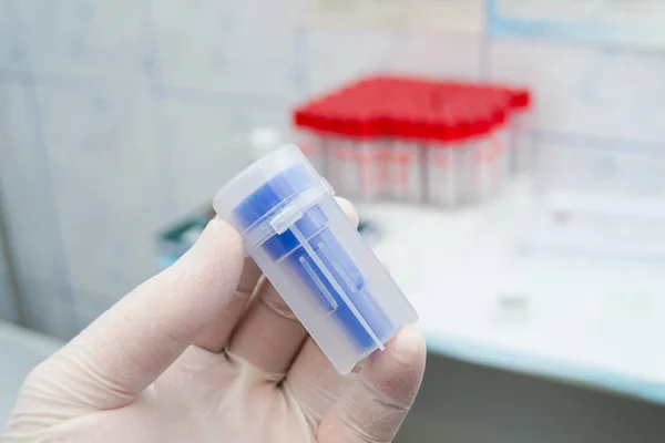 Trabajador de laboratorio sosteniendo en su mano una botella para muestras de heces — Foto de Stock