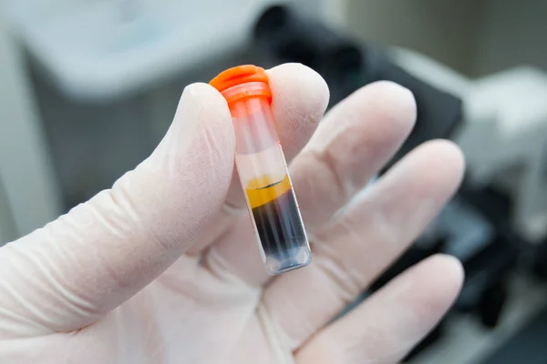 Videnskabsmand holder i hånden en centrifugeret blodprøve - Stock-foto