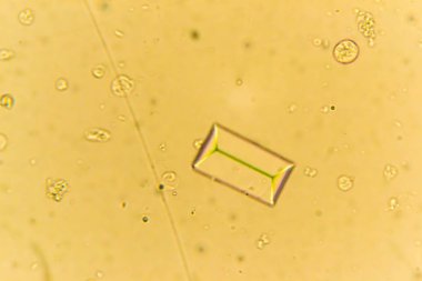 Mikroskobun içinde struvites. İdrar örneği işemek bir köpek