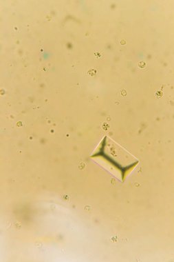 Mikroskobun içinde struvites. İdrar örneği işemek bir köpek