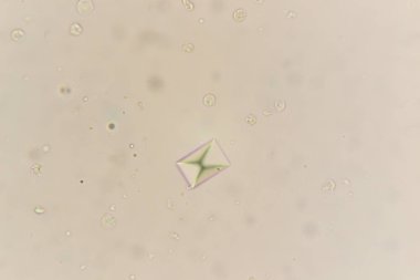 Kalsiyum oksalat, mikroskop. Kedi idrar örneği 