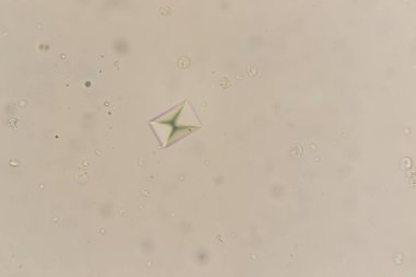 Kalsiyum oksalat, mikroskop. Kedi idrar örneği 