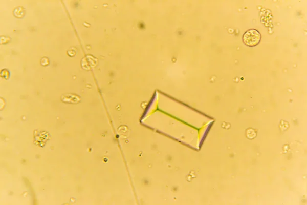 Struvites at the microscope. Urine sample from a dog who urinate — Stock Photo, Image