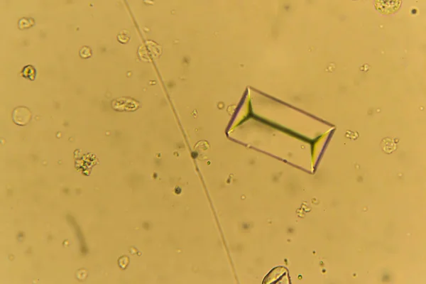 Struvites at the microscope. Urine sample from a dog who urinate — Stock Photo, Image