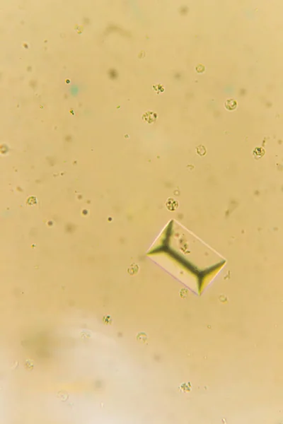 Струвиты у микроскопа. Образец мочи собаки, которая мочится — стоковое фото