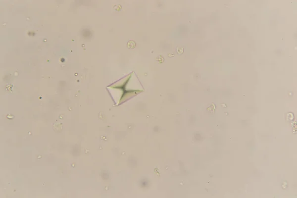 Šťavelan vápenatý u mikroskopu. Vzorek moči od kočky — Stock fotografie