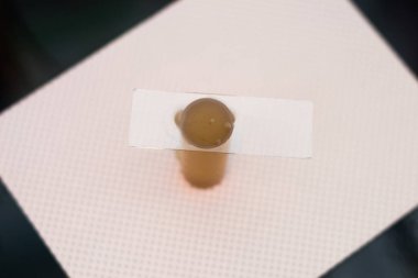 yüzdürme yöntemi ile koproparazitolojik inceleme