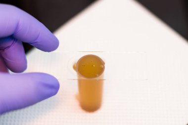 vete de yüzdürme yöntemi ile koproparazitolojik inceleme