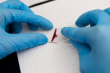 veteriner bir kan yayma hazırlanıyor 