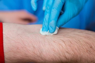 doktor kateteri yerleştirmek için bir adamın elini hazırlıyor