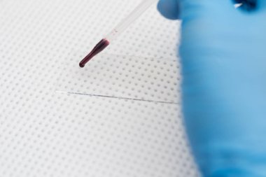 veteriner bir kan yayma hazırlanıyor 