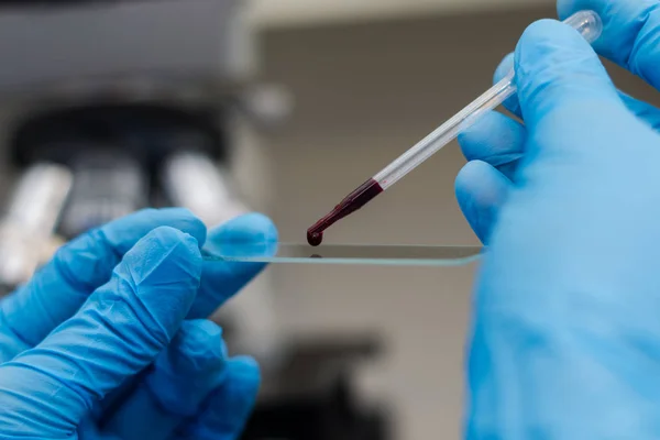 El veterinario poniendo una gota de sangre en la superficie de un micrófono — Foto de Stock