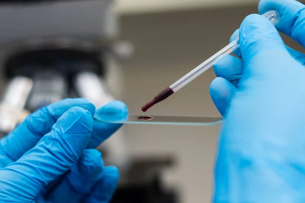 Ветеринар кладе краплю крові на поверхню мікроскопа — стокове фото