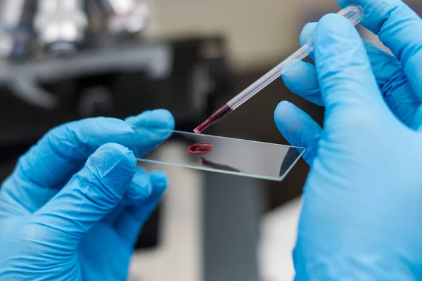 El veterinario poniendo una gota de sangre en la superficie de un micrófono — Foto de Stock