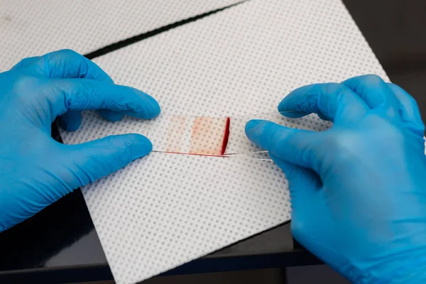 El veterinario está preparando un frotis de sangre — Foto de Stock