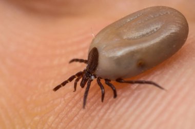 İnsan cilt yüzeyinde kene