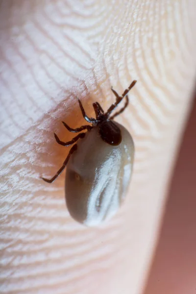 Tick Sulla Superficie Della Pelle Umana — Foto Stock