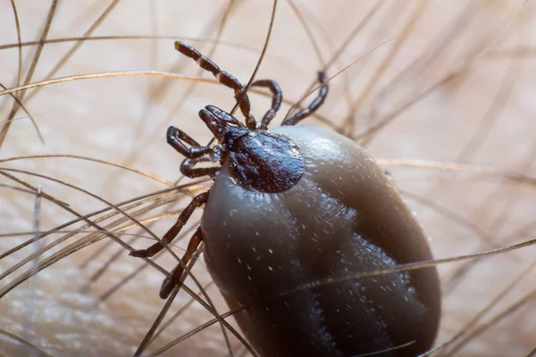 Tick Sulla Superficie Della Pelle Umana — Foto Stock