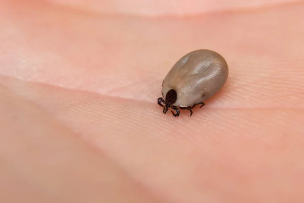 Fat tick on human skin — Stock Photo, Image