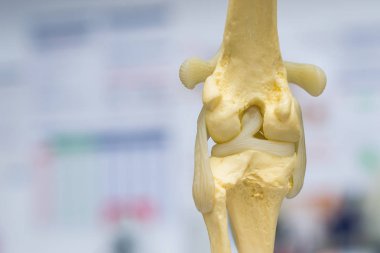 köpek diz eklem ilik arka görünümü, menisküs ve çapraz bağ