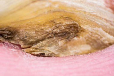 Mantar ile bir insan ayak tırnağı Makro fotoğraf