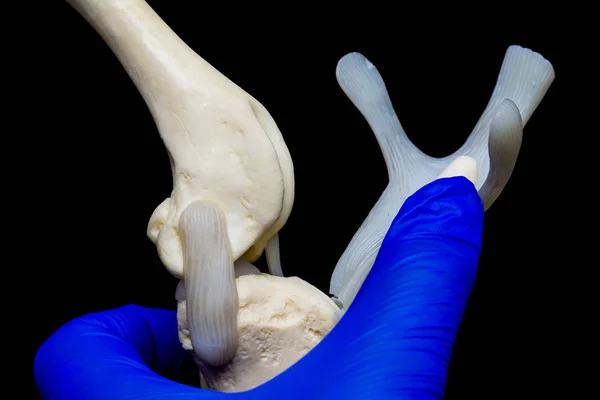 Molde de la articulación de la rodilla del perro en la mano del veterinario y ba negro — Foto de Stock