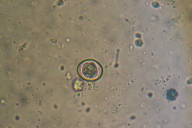 enfekte s izole Eimeria / Isospora unsporulated oocyst