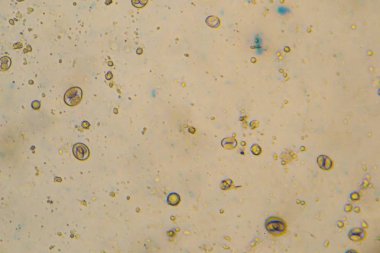 enfekte sa izole Eimeria / Isospora sporlu ookistler