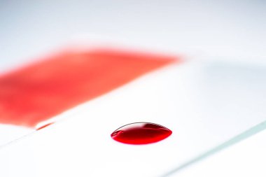 Kan yayması Hematoloji mikroskobik inceleme için