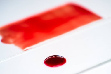 Kan yayması Hematoloji mikroskobik inceleme için