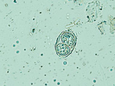 Mikroskop altında toksoplazma gondii oocyst, izole