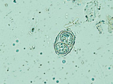 Toxoplasma gondii oocyst under the microscope, isolated clipart