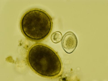 Toxocara cati iki yumurta ve Isospora felis unde iki ookist