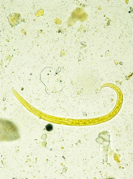 Aelurostrongylus abstrusus larva izolovaný pod mikroskopem — Stock fotografie