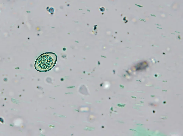 Isospora spp. oocyste des excréments de chat au microscope — Photo