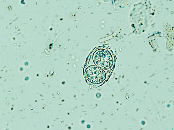 Toxoplasma gondii oocyst под микроскопом, изолирован — стоковое фото