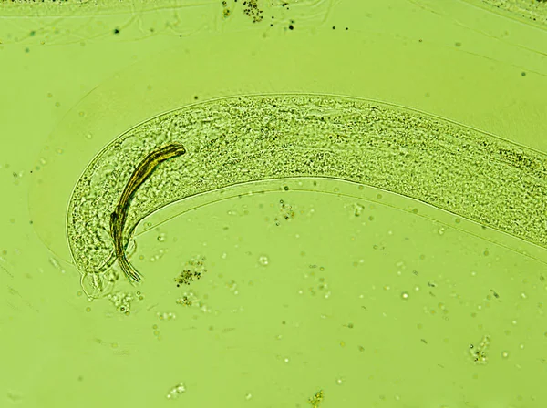 The tail of Aelurostrongylus abstrusus, cat lungworm under the m — Stock Photo, Image