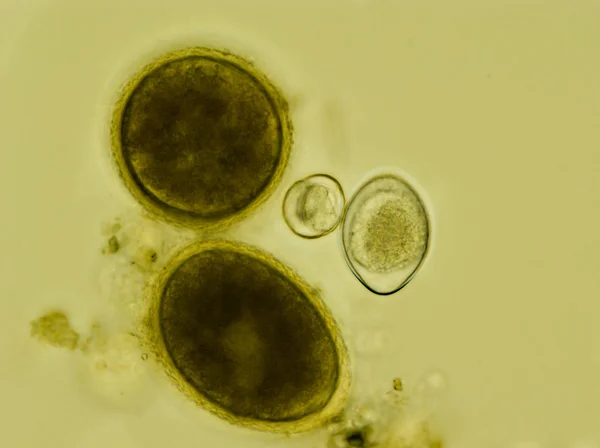 Два яйця Toxocara cati і два ооцисти Isospora felis un — стокове фото