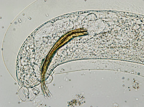 The tail of Aelurostrongylus abstrusus, cat lungworm under the m — Stock Photo, Image